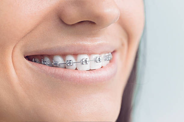 Why Choose Us for Your Dental Needs in Wabasso, FL